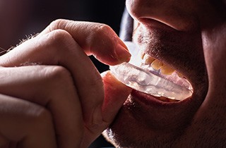 Wear a protective mouthguard if you play sports