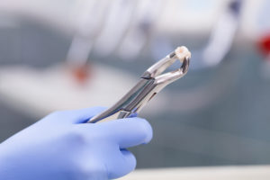 Dental instrument holding an extracted tooth
