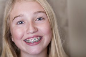A young girl with braces smiling.