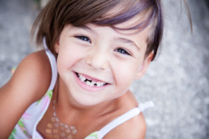 little girl with missing teeth smiling