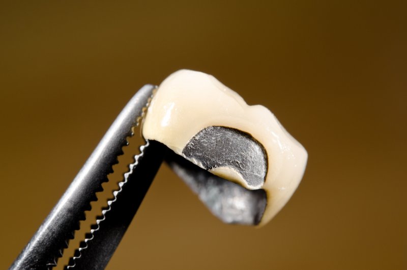 Broken Dental Crowns In Northwest Dallas How Do Crowns Break?