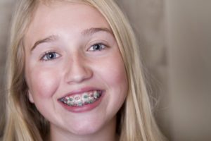 young person with braces