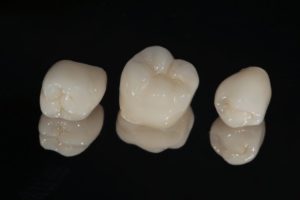 dental crowns against a dark backdrop