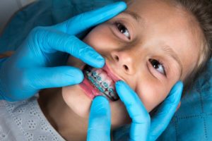 Child with braces