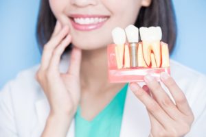 Mesquite dentist holding model jaw with dental implant