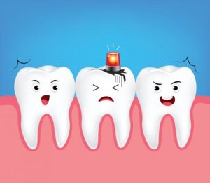 Cartoon of three teeth, the one in the middle has a siren light and a sad face