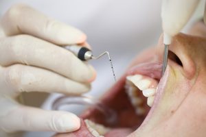 treatment from dentist in Mesquite