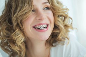 young woman with metal braces 