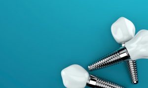 a closeup of dental implants against a blue background