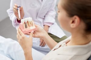 a patient holding a model of dental implants in North Dallas