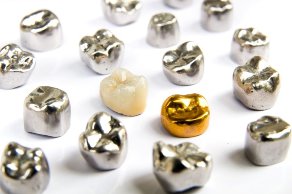 A variety of different types of dental crowns